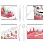 Bežični Dentalni Irigator - 4 Nastavka