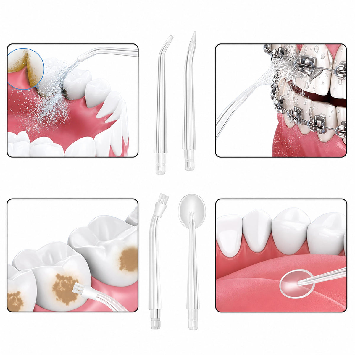 Bežični Dentalni Irigator - 4 Nastavka
